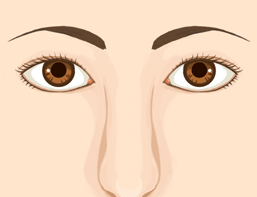 上瞼(うえまぶた)・目の上の切開法4